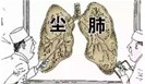  你离“石头”肺有多远？ 